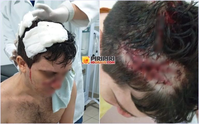 Homem se finge de morto e escapa da morte após levar facada na cabeça no Piauí