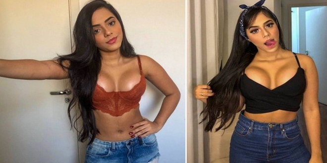 Gêmeas Lacração posam após colocarem silicone nos seios aos 19 anos