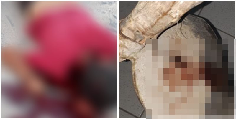 Briga de bar termina com homem em estado grave após ser agredido com enxada no Piauí
